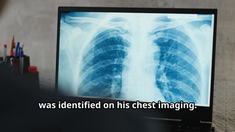 A Diagnosis Missed by Many